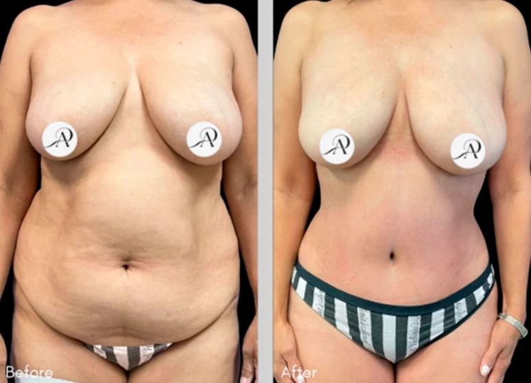 B&A - 01