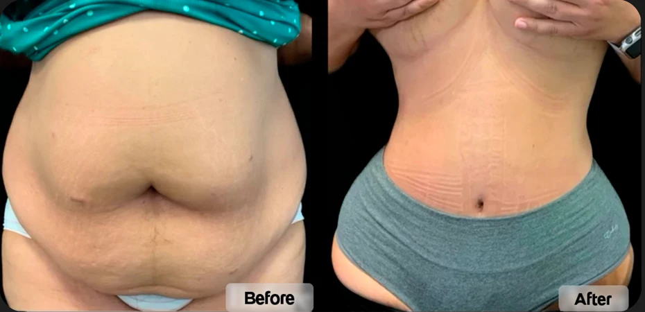 B&A - 02